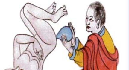 缓导泻法