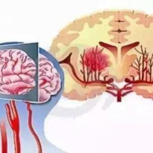 青海省藏医院脑病科