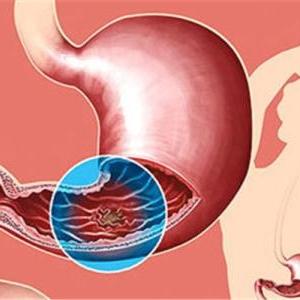 青海省藏医院脾胃科